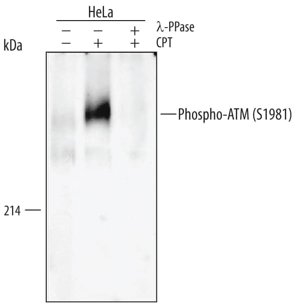 Western blot shows lysates of HeLa human cervical epithelial carcinoma cell line untreated (-) or treated (+) with 1 µM camptothecin (CPT) for 1 hour. PVDF membrane was probed with 1 µg/mL Rabbit Anti-Human/Mouse/Rat Phospho-ATM (S1981) Antigen Affinity-purified Polyclonal Antibody (Catalog # AF1655) followed by HRP-conjugated Anti-Rabbit IgG Secondary Antibody (Catalog # HAF008). A specific band for Phospho-ATM (S1981) was detected at approximately 370 kDa (as indicated). The phospho-specificity of this antibody was supported by decreased labeling following treatment with 600 U lambda-phosphatase (lambda-PPase) for 1 hour. This experiment was conducted under reducing conditions and using Immunoblot Buffer Group 1.