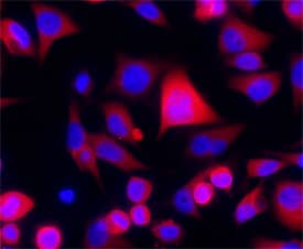 ATM was detected in immersion fixed HeLa human cervical epithelial carcinoma cell line using Mouse Anti-Human ATM Monoclonal Antibody (Catalog # MAB22901) at 25 µg/mL for 3 hours at room temperature. Cells were stained using the NorthernLights™ 557-conjugated Anti-Mouse IgG Secondary Antibody (red; Catalog # NL007) and counterstained with DAPI (blue). Specific staining was localized to cytoplasm. View our protocol for Fluorescent ICC Staining of Cells on Coverslips.
