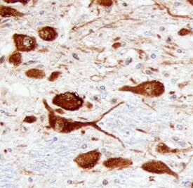 ATN1 was detected in immersion fixed paraffin-embedded sections of human brain (hypothalamus) using Sheep Anti-Human/Mouse ATN1 Antigen Affinity-purified Polyclonal Antibody (Catalog # AF6567) at 3 µg/mL overnight at 4 °C. Before incubation with the primary antibody, tissue was subjected to heat-induced epitope retrieval using Antigen Retrieval Reagent-Basic (Catalog # CTS013). Tissue was stained using the Anti-Sheep HRP-DAB Cell & Tissue Staining Kit (brown; Catalog # CTS019) and counterstained with hematoxylin (blue). Specific staining was localized to neuronal cytoplasm. View our protocol for Chromogenic IHC Staining of Paraffin-embedded Tissue Sections.