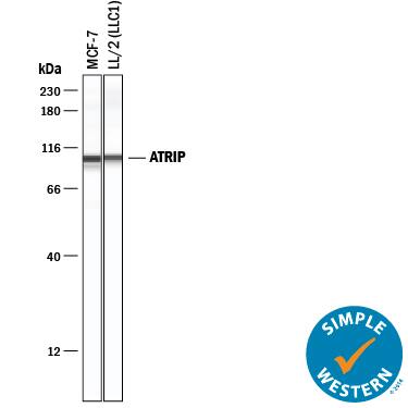Simple Western lane view shows lysates of MCF-7 human breast cancer cell line and LL/2 mouse Lewis lung carcinoma cell line, loaded at 0.2 mg/mL. A specific band was detected for ATRIP at approximately 100 kDa (as indicated) using 10 µg/mL of Sheep Anti-Human ATRIP Antigen Affinity-purified Polyclonal Antibody (Catalog # AF1579) followed by 1:50 dilution of HRP-conjugated Anti-Sheep IgG Secondary Antibody (Catalog # HAF016). This experiment was conducted under reducing conditions and using the 12-230 kDa separation system.