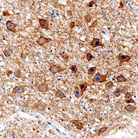 Acetylcholinesterase/ACHE was detected in immersion fixed paraffin-embedded sections of human brain (substantia nigra) using Sheep Anti-Human Acetylcholinesterase/ACHE Antigen Affinity-purified Polyclonal Antibody (Catalog # AF7574) at 3 µg/mL overnight at 4 °C. Tissue was stained using the Anti-Sheep HRP-DAB Cell & Tissue Staining Kit (brown; Catalog # CTS019) and counterstained with hematoxylin (blue). Specific staining was localized to cytoplasm in neurons. View our protocol for Chromogenic IHC Staining of Paraffin-embedded Tissue Sections.