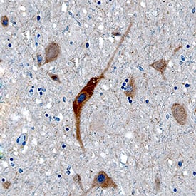 Acetylcholinesterase/ACHE was detected in immersion fixed paraffin-embedded sections of human brain (substantia nigra) using Mouse Anti-Human Acetylcholinesterase/ACHE Monoclonal Antibody (Catalog # MAB7574) at 15 µg/mL overnight at 4 °C. Tissue was stained using the Anti-Mouse HRP-DAB Cell & Tissue Staining Kit (brown; Catalog # CTS002) and counterstained with hematoxylin (blue). Specific staining was localized to neurons. View our protocol for Chromogenic IHC Staining of Paraffin-embedded Tissue Sections.