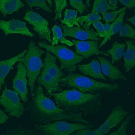 Actin was detected in immersion fixed HeLa human cervical epithelial carcinoma cell line using Sheep Anti-Human/Mouse/Rat Actin Antigen Affinity-purified Polyclonal Antibody (Catalog # AF4000) at 10 µg/mL for 3 hours at room temperature. Cells were stained using the NorthernLights™ 493-conjugated Anti-Sheep IgG Secondary Antibody (green; Catalog # NL012) and counterstained with DAPI (blue). View our protocol for Fluorescent ICC Staining of Cells on Coverslips.