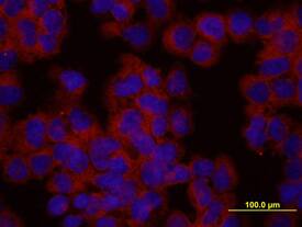 Actin was detected in immersion fixed HEK293 human embryonic kidney cell line using Sheep Anti-Human/Mouse/Rat Actin Antigen Affinity-purified Polyclonal Antibody (Catalog # AF4000) at 10 µg/mL for 3 hours at room temperature. Cells were stained using the NorthernLights™ 557-conjugated Anti-Sheep IgG Secondary Antibody (red; Catalog # NL010) and counterstained with DAPI (blue). View our protocol for Fluorescent ICC Staining of Cells on Coverslips.