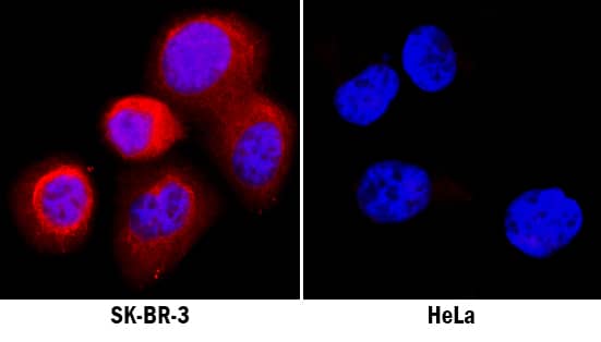 Activin A was detected in immersion fixed SK-BR-3 human breast cancer cell line (left panel, positive stain) and HeLa human cervical epithelial carcinoma cell line (right panel, negative stain) using Goat Anti-Human/Mouse/Rat Activin A  beta A subunit Antigen Affinity-purified Polyclonal Antibody (Catalog # AF338) at 5 µg/mL for 3 hours at room temperature. Cells were stained using the NorthernLights™ 557-conjugated Anti-Goat IgG Secondary Antibody (red; Catalog # NL001) and counterstained with DAPI (blue). Specific staining was localized to endoplasmic reticuli. View our protocol for Fluorescent ICC Staining of Cells on Coverslips.