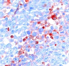Immunohistochemistry Activin RIA/ALK-2/Activin Receptor Type 1 Antibody