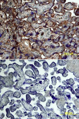 Immunohistochemistry Activin RIA/ALK-2/Activin Receptor Type 1 Antibody