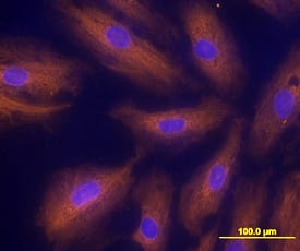 Activin RIA/ALK-2 was detected in immersion fixed HUVEC human umbilical vein endothelial cells using Mouse Anti-Human Activin RIA/ALK-2 Monoclonal Antibody (Catalog # MAB637) at 10 µg/mL for 3 hours at room temperature. Cells were stained using the NorthernLights™ 557-conjugated Anti-Mouse IgG Secondary Antibody (orange; Catalog # NL007) and counterstained with DAPI (blue). Specific staining was localized to cytoplasm. View our protocol for Fluorescent ICC Staining of Cells on Coverslips.