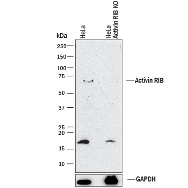 <b>Genetic Strategies Validation. </b>Western blot shows lysates of HeLa human cervical epithelial carcinoma parental cell line and Activin RIB/ALK-4 knockout HeLa cell line (KO). PVDF membrane was probed with 1 µg/mL of Goat Anti-Human Activin RIB/ALK-4 Antigen Affinity-purified Polyclonal Antibody (Catalog # AF222) followed by HRP-conjugated Anti-Goat IgG Secondary Antibody (Catalog # HAF017). A specific band was detected for Activin RIB/ALK-4 at approximately 70 kDa (as indicated) in the parental HeLa cell line, but is not detectable in knockout HeLa cell line. GAPDH (Catalog # AF5718) is shown as a loading control. This experiment was conducted under reducing conditions and using Immunoblot Buffer Group 1.