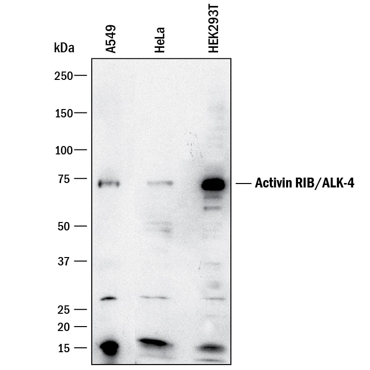 Western blot shows lysates of A549 human lung carcinoma cell line, HeLa human cervical epithelial carcinoma cell line, and HEK293T human embryonic kidney cell line. PVDF membrane was probed with 1 µg/mL of Goat Anti-Human Activin RIB/ALK-4 Antigen Affinity-purified Polyclonal Antibody (Catalog # AF222) followed by HRP-conjugated Anti-Goat IgG Secondary Antibody (Catalog # HAF017). A specific band was detected for Activin RIB/ALK-4 at approximately 70 kDa (as indicated). This experiment was conducted under reducing conditions and using Immunoblot Buffer Group 1.
