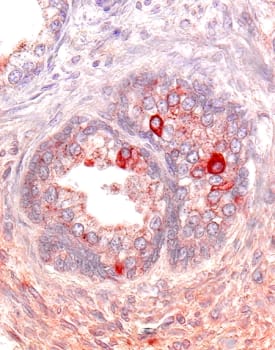 Immunohistochemistry Activin RIIA Antibody [Unconjugated]
