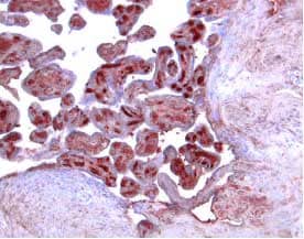 Immunohistochemistry Activin RIIB Antibody