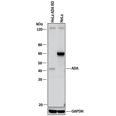 Western blot shows lysates of HeLa human cervical epithelial carcinoma parental cell line and Adenosine Deaminase/ADA knockout HeLa cell line (KO). PVDF membrane was probed with 1 µg/mL of Sheep Anti-Human/Mouse Adenosine Deaminase/ADA Antigen Affinity-purified Polyclonal Antibody (Catalog # AF7048) followed by HRP-conjugated Anti-Sheep IgG Secondary Antibody (Catalog # HAF016). A specific band was detected for Adenosine Deaminase/ADA at approximately 45 kDa (as indicated) in the parental HeLa cell line, but is not detectable in knockout HeLa cell line. GAPDH (Catalog # AF5718) is shown as a loading control. This experiment was conducted under reducing conditions and using Immunoblot Buffer Group 1. New adjunct appears with knockout cell line.