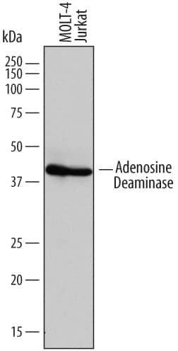 Western blot shows lysates of MOLT-4 human acute lymphoblastic leukemia cell line and Jurkat human acute T cell leukemia cell line. PVDF membrane was probed with 1 µg/mL of Sheep Anti-Human Adenosine Deaminase/ADA Antigen Affinity-purified Polyclonal Antibody (Catalog # AF7048) followed by HRP-conjugated Anti-Sheep IgG Secondary Antibody (Catalog # HAF016). A specific band was detected for Adenosine Deaminase/ ADA at approximately 41 kDa (as indicated). This experiment was conducted under reducing conditions and using Immunoblot Buffer Group 1.