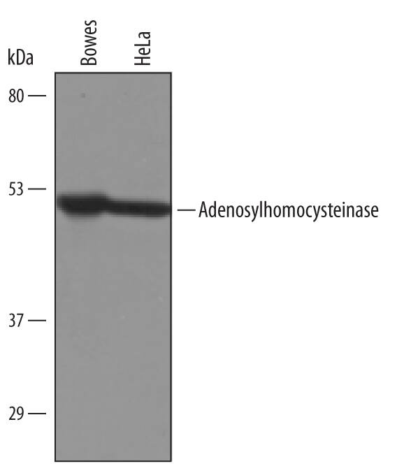Western Blot Adenosylhomocysteinase/AHCY Antibody [Unconjugated]
