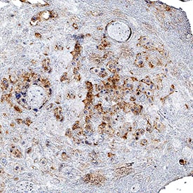 AdipoR1 was detected in immersion fixed paraffin-embedded sections of human placenta using Rabbit Anti-Human AdipoR1 Monoclonal Antibody (Catalog # MAB10128) at 3 µg/mL for 1 hour at room temperature followed by incubation with the Anti-Rabbit IgG VisUCyte™ HRP Polymer Antibody (Catalog # VC003). Before incubation with the primary antibody, tissue was subjected to heat-induced epitope retrieval using Antigen Retrieval Reagent-Basic (Catalog # CTS013). Tissue was stained using DAB (brown) and counterstained with hematoxylin (blue). Specific staining was localized to cell membrane in decidual cells. View our protocol for IHC Staining with VisUCyte HRP Polymer Detection Reagents.