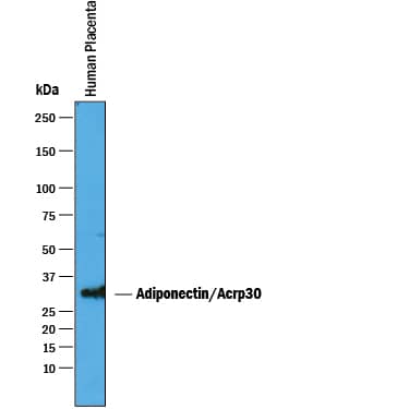 Western Blot Adiponectin/Acrp30 Antibody [Unconjugated]