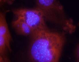 Adiponectin/Acrp30 was detected in immersion fixed ST-2 mouse bone marrow-derived stromal cell line differentiated to adipocytes using Goat Anti-Mouse Adiponectin/Acrp30 Antigen Affinity-purified Polyclonal Antibody (Catalog # AF1119) at 10 µg/mL for 3 hours at room temperature. Cells were stained using the NorthernLights™ 557-conjugated Anti-Goat IgG Secondary Antibody (red; NL001) and counter-stained with DAPI (blue). Specific staining was localized to cell surfaces and cytoplasm. View our protocol for Fluorescent ICC Staining of Cells on Coverslips.