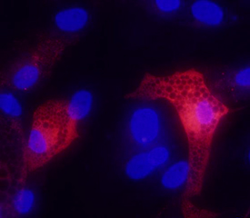 Immunocytochemistry Adiponectin/Acrp30 Antibody [Unconjugated]