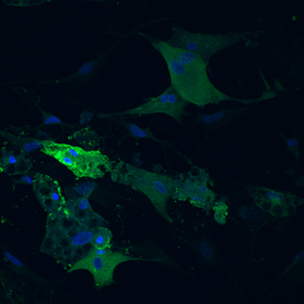 Adiponectin/Adipocyte complement-related protein of 30 kDa (ACRP-30) was detected in rat adipocytes using Goat Anti-Rat Adiponectin/Acrp30 Antigen Affinity-purified Polyclonal Antibody (Catalog # AF3100) at 10 µg/mL for 3 hours at room temperature. Cells were stained using the NorthernLights™ 557-conjugated Anti-Goat IgG Secondary Antibody (yellow; Catalog # NL001) and counterstained with DAPI (blue). View our protocol for Fluorescent ICC Staining of Cells on Coverslips.