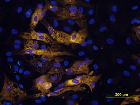 Adiponectin/Acrp30 was detected in immersion fixed mouse mesenchymal stem cells differentiated into adipocytes using Goat Anti-Rat Adiponectin/Acrp30 Antigen Affinity-purified Polyclonal Antibody (Catalog # AF3100) at 10 µg/mL for 3 hours at room temperature. Cells were stained using the NorthernLights™ 557-conjugated Anti-Goat IgG Secondary Antibody (yellow; Catalog # NL001) and counterstained with DAPI (blue). View our protocol for Fluorescent ICC Staining of Cells on Coverslips.