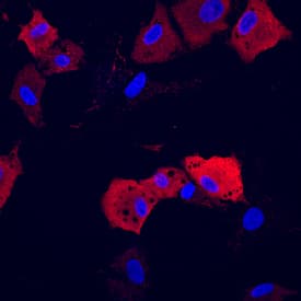 Adiponectin/Acrp30 was detected in Immersion fixed rat mesenchymal stem cells differentiated into adipocytes with Human/Mouse/Rat StemXVivo Adipogenic Supplement (Catalog # CCM011) using Mouse Anti-Rat Adiponectin/Acrp30 Monoclonal Antibody (Catalog # MAB3100) at 10 µg/mL for 3 hours at room temperature. Cells were stained using the NorthernLights™ 557-conjugated Anti-Mouse IgG Secondary Antibody (red; Catalog # NL007) and counterstained with DAPI (blue). Specific staining was localized to cytoplasm. View our protocol for Fluorescent ICC Staining of Cells on Coverslips.
