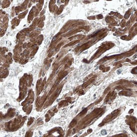 Immunohistochemistry Adrenomedullin/ADM Antibody [Unconjugated]