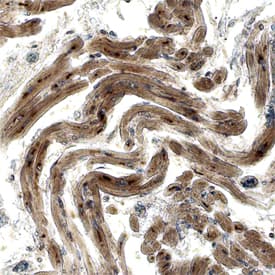 Immunohistochemistry Adrenomedullin/ADM Antibody (357923)