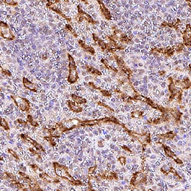 Immunohistochemistry Adrenomedullin R/ADMR/GPR182 Antibody (528563) [Unconjugated]
