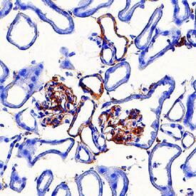 Adropin was detected in perfusion fixed frozen sections of mouse kidney using Mouse Anti-Human Adropin Monoclonal Antibody (Catalog # MAB9690) at 5 µg/mL for 1 hour at room temperature followed by incubation with the Anti-Mouse IgG VisUCyte™ HRP Polymer Antibody (VC001). Tissue was stained using DAB (brown) and counterstained with hematoxylin (blue). Specific staining was localized to cytoplasm in glomeruli. View our protocol for IHC Staining with VisUCyte HRP Polymer Detection Reagents.