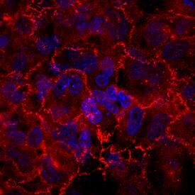 Afadin/AF-6 was detected in immersion fixed BEAS2B human lung epithelial cell line using Sheep Anti-Human Afadin/AF-6 Antigen Affinity-purified Polyclonal Antibody (Catalog # AF7829) at 1.7 µg/mL for 3 hours at room temperature. Cells were stained using the NorthernLights™ 557-conjugated Anti-Sheep IgG Secondary Antibody (red; Catalog # NL010) and counterstained with DAPI (blue). Specific staining was localized to plasma membrane. View our protocol for Fluorescent ICC Staining of Cells on Coverslips.