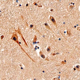 Afadin/AF-6 was detected in immersion fixed paraffin-embedded sections of human brain (hippocampus) using Sheep Anti-Human Afadin/AF-6 Antigen Affinity-purified Polyclonal Antibody (Catalog # AF7829) at 3 µg/mL overnight at 4 °C. Tissue was stained using the Anti-Sheep HRP-DAB Cell & Tissue Staining Kit (brown; Catalog # CTS019) and counterstained with hematoxylin (blue). Specific staining was localized to neuronal cell bodies and processes. View our protocol for Chromogenic IHC Staining of Paraffin-embedded Tissue Sections.
