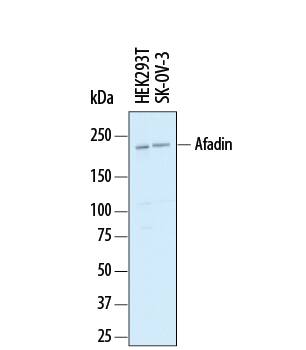 Western blot shows lysates of HEK293T human embryonic kidney cell line and SK-OV-3 human ovarian adenocarcinoma cell line. PVDF membrane was probed with 1 µg/mL of Sheep Anti-Human Afadin/AF-6 Antigen Affinity-purified Polyclonal Antibody (Catalog # AF7829) followed by HRP-conjugated Anti-Sheep IgG Secondary Antibody (Catalog # HAF016). A specific band was detected for Afadin/AF-6 at approximately 220 kDa (as indicated). This experiment was conducted under reducing conditions and using Immunoblot Buffer Group 1.