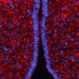 AgRP/ART was detected in perfusion fixed frozen sections of mouse brain (hypothalamus) using Goat Anti-Mouse AgRP/ART Antigen Affinity-purified Polyclonal Antibody (Catalog # AF634) at 1.7 µg/mL overnight at 4 °C. Tissue was stained using the NorthernLights™ 557-conjugated Anti-Goat IgG Secondary Antibody (red; NL001) and counterstained with DAPI (blue). View our protocol for Fluorescent IHC Staining of Frozen Tissue Sections.
