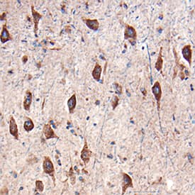 AgRP/ART was detected in immersion fixed paraffin-embedded sections of human brain (hippocampus) using Goat Anti-Human AgRP/ART Antigen Affinity-purified Polyclonal Antibody (Catalog # AF704) at 15 &micro;g/mL overnight at 4 &deg;C. Before incubation with the primary antibody tissue was subjected to heat-induced epitope retrieval using Antigen Retrieval Reagent-Basic (Catalog # CTS013). Tissue was stained using the Anti-Goat HRP-DAB Cell & Tissue Staining Kit (brown ; Catalog # CTS008) and counterstained with hematoxylin (blue). Specific labeling was localized to the cytoplasm of neurons. View our protocol for Chromogenic IHC Staining of Paraffin-embedded Tissue Sections.