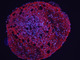 Aggrecan was detected in immersion fixed rat mesenchymal stem cells differentiated to chondrocytes using Goat Anti-Human Aggrecan G1-IGD-G2 Domains Antigen Affinity-purified Polyclonal Antibody (Catalog # AF1220) at 10 µg/mL for 3 hours at room temperature. Cells were stained using the NorthernLights™ 557-conju-gated Anti-Goat IgG Secondary Antibody (red; Catalog # NL001) and counterstained with DAPI (blue). View our protocol for Fluorescent ICC Staining of Cells on Coverslips.