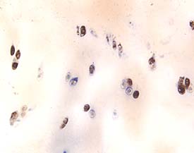 Aggrecan was detected in immersion fixed paraffin-embedded sections of human cartilage using 15 &micro;g/mL Goat Anti-Human Aggrecan G1-IGD-G2 Domains Antigen Affinity-purified Polyclonal Antibody (Catalog # AF1220) overnight at 4 &deg;C. Tissue was stained with the Anti-Goat HRP-DAB Cell & Tissue Staining Kit (brown; Catalog # CTS008) and counterstained with hematoxylin (blue). View our protocol for Chromogenic IHC Staining of Paraffin-embedded Tissue Sections.