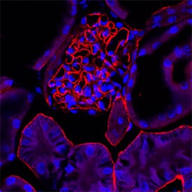 Agrin was detected in perfusion fixed frozen sections of mouse kidney using Goat Anti-Rat Agrin Antigen Affinity-purified Polyclonal Antibody (Catalog # AF550) at 0.1 µg/mL overnight at 4 °C. Tissue was stained using the Northern-Lights™ 557-conjugated Anti-Goat IgG Secondary Antibody (red; Catalog # NL001) and counterstained with DAPI (blue). Specific staining was localized to basement membrane of epithelial cells in tubules and endothelial cells in glomeruli. View our protocol for Fluorescent IHC Staining of Frozen Tissue Sections.