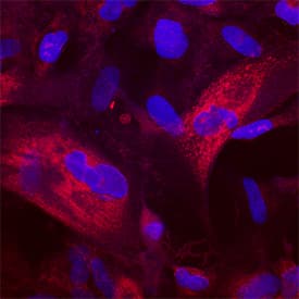 <b>Biological Strategies Validation. </b>Akt1 phosphorylated at T308 was detected in immersion fixed CCD-1070Sk human foreskin fibroblast cell line stimulated with Recombinant Human PDGF-BB (Catalog # 220-BB) using Mouse Anti-Human Phospho-Akt1 (T308) Mono-clonal Antibody (Catalog # MAB7419) at 25 µg/mL for 3 hours at room temperature. Cells were stained using the Northern-Lights™ 557-conjugated Anti-Mouse IgG Secondary Antibody (red; Catalog # NL007) and counterstained with DAPI (blue). Specific staining was localized to cytoplasm. View our protocol for Fluorescent ICC Staining of Cells on Coverslips.
