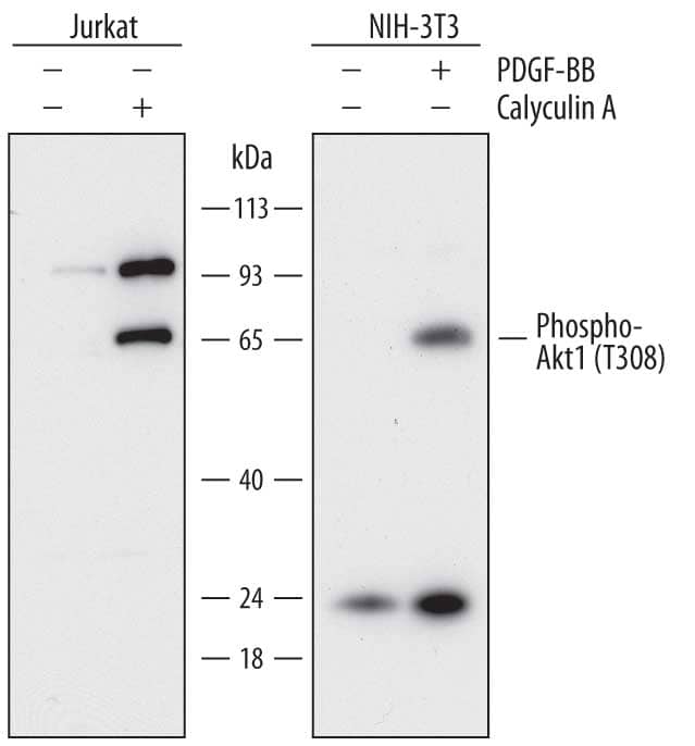 Western blot shows lysates of Jurkat human acute T cell leukemia cell line and NIH-3T3 mouse embryonic fibroblast cell line untreated (-) or treated (+) with 100 ng/mL Recombinant Human PDGF-BB (Catalog # 220-BB) for 20 minutes or 100nM Calyculin A for 30 minutes. PVDF membrane was probed with 1 µg/mL of Mouse Anti-Human Phospho-Akt1 (T308) Monoclonal Antibody (Catalog # MAB7419) followed by HRP-conjugated Anti-Mouse IgG Secondary Antibody (Catalog # HAF018). A specific band was detected for Phospho-Akt1 (T308) at approximately 65 kDa (as indicated). This experiment was conducted under reducing conditions and using Immunoblot Buffer Group 1.