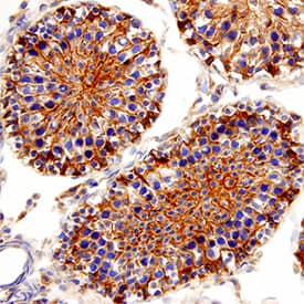 Immunohistochemistry AKT2 Antibody [Unconjugated]
