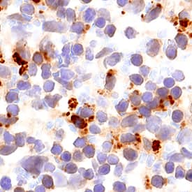 Immunohistochemistry AKT2 Antibody [Unconjugated]