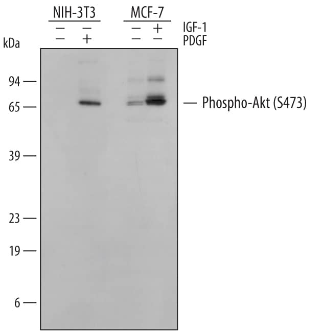 Western blot shows lysates of NIH-3T3 mouse embryonic fibroblast cell line untreated (-) or treated (+) with 100 ng/mL Human PDGF (120-HD) for 15 minutes and MCF-7 human breast cancer cell line untreated or treated with 100 ng/mL Recombinant Human IGF-1 (291-G1) for 15 minutes. PVDF membrane was probed with 0.5 µg/mL of Rabbit Anti-Human/Mouse/Rat Phospho-Akt (S473) Pan Specific Antigen Affinity-purified Polyclonal Antibody (Catalog # AF887), followed by HRP-conjugated Anti-Rabbit IgG Secondary Antibody (HAF008). A specific band was detected for Phospho-Akt (S473) Pan Specific at approximately 60 kDa (as indicated). This experiment was conducted under reducing conditions and using Immunoblot Buffer Group 1.