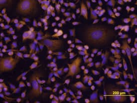 Akt was detected in immersion fixed MDA-MB-231 human breast cancer cell line using Mouse Anti-Human/ Mouse/Rat Akt Monoclonal Antibody (Catalog # MAB2055) at 10 µg/mL for 3 hours at room temperature. Cells were stained using the NorthernLights™ 557-conjugated Anti-Mouse IgG Secondary Antibody (yellow; Catalog # NL007) and counter-stained with DAPI (blue). View our protocol for Fluorescent ICC Staining of Cells on Coverslips.