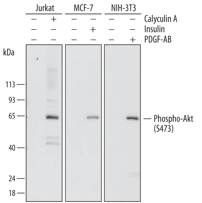 Western blot shows lysates of Jurkat human acute T cell leukemia cell line, MCF-7 human breast cancer cell line, and NIH-3T3 mouse embryonic fibroblast cell line untreated (-) or treated (+) with 100 nm Calyculin for 30 minutes, 1 µg/mL insulin for 5 minutes, or 100 ng/mL Recombinant Human PDGF-AB (Catalog # 222-AB) for 20 minutes. PVDF membrane was probed with 0.2 µg/mL of Mouse Anti-Human Phospho-Akt (S473) Pan Specific Monoclonal Antibody (Catalog # MAB887) followed by HRP-conjugated Anti-Mouse IgG Secondary Antibody (Catalog # HAF007). A specific band was detected for Phospho-Akt (S473) at approximately 65 kDa (as indicated). This experiment was conducted under reducing conditions and using Immunoblot Buffer Group 1.
