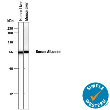 Simple Western lane view shows lysates of human liver tissue and mouse liver tissue, loaded at 0.2 mg/mL. A specific band was detected for Albumin at approximately 64 kDa (as indicated) using 10 µg/mL of Goat Anti-Human/Mouse Serum Albumin Antigen Affinity-purified Polyclonal Antibody (Catalog # AF3329) followed by 1:50 dilution of HRP-conjugated Anti-Goat IgG Secondary Antibody (Catalog # HAF109). This experiment was conducted under reducing conditions and using the 12-230 kDa separation system.