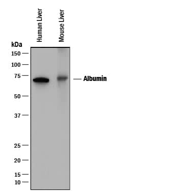 Western blot shows lysates of human liver tissue and mouse liver tissue. PVDF membrane was probed with 0.1 µg/mL of Goat Anti-Human/Mouse Serum Albumin Antigen Affinity-purified Polyclonal Antibody (Catalog # AF3329) followed by HRP-conjugated Anti-Goat IgG Secondary Antibody (Catalog # HAF017). A specific band was detected for Serum Albumin at approximately 65-70 kDa (as indicated). This experiment was conducted under reducing conditions and using Immunoblot Buffer Group 1.