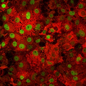 Immunocytochemistry Albumin Antibody (188835) [Unconjugated] - Serum