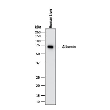 Western blot shows lysate of human liver tissue. PVDF membrane was probed with 1 µg/mL of Mouse Anti-Human Serum Albumin Monoclonal Antibody (Catalog # MAB1455) followed by HRP-conjugated Anti-Mouse IgG Secondary Antibody (Catalog # HAF018). A specific band was detected for Albumin at approximately 65-70 kDa (as indicated). This experiment was conducted under reducing conditions and using Immunoblot Buffer Group 1.