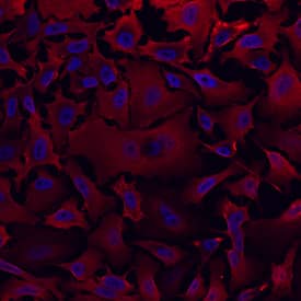 Immunocytochemistry Aldehyde Dehydrogenase 1-A1/ALDH1A1 Antibody [Unconjugated]
